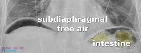Free air deals